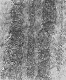 心肌細胞線粒體