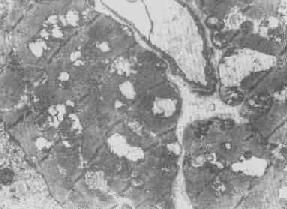 線粒體腫脹(基質型)空泡變(心肌缺氧)