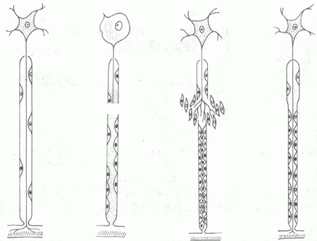 神經纖維再生模式圖