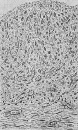肉芽組織鏡下結構模式圖