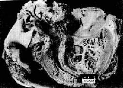 三、各器官的病變